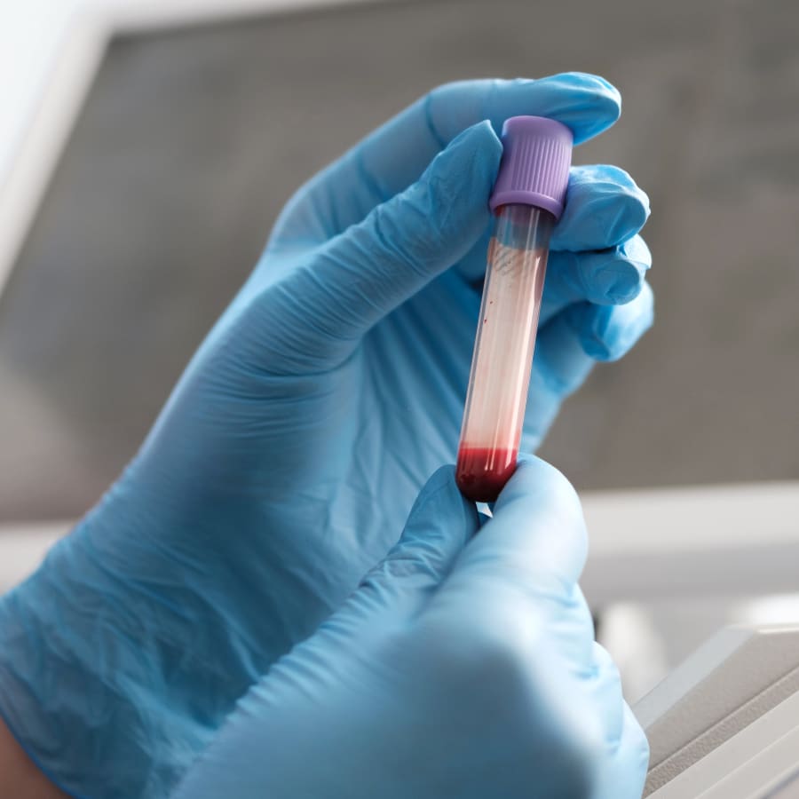 Blood sample in lab for diagnosis at Laguna Woods Vet